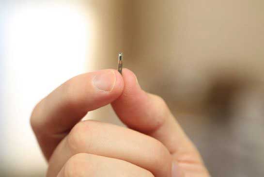 Microchip yang ditanam di tangan Sjostorm (foto: thestar.com)